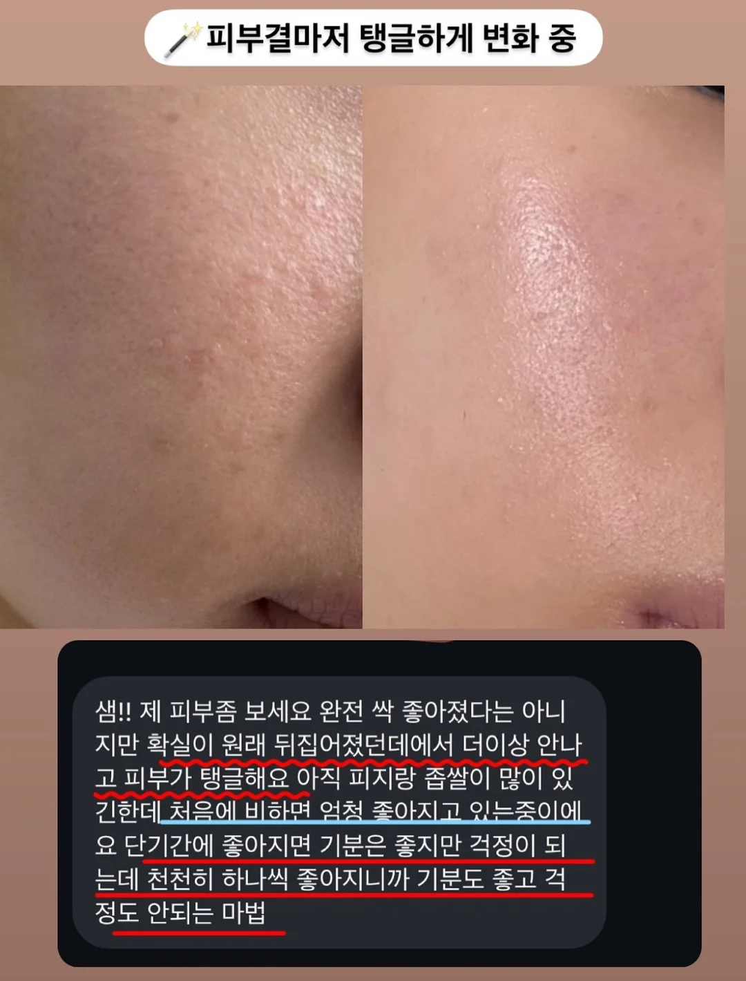 계란 우유 레시피 5