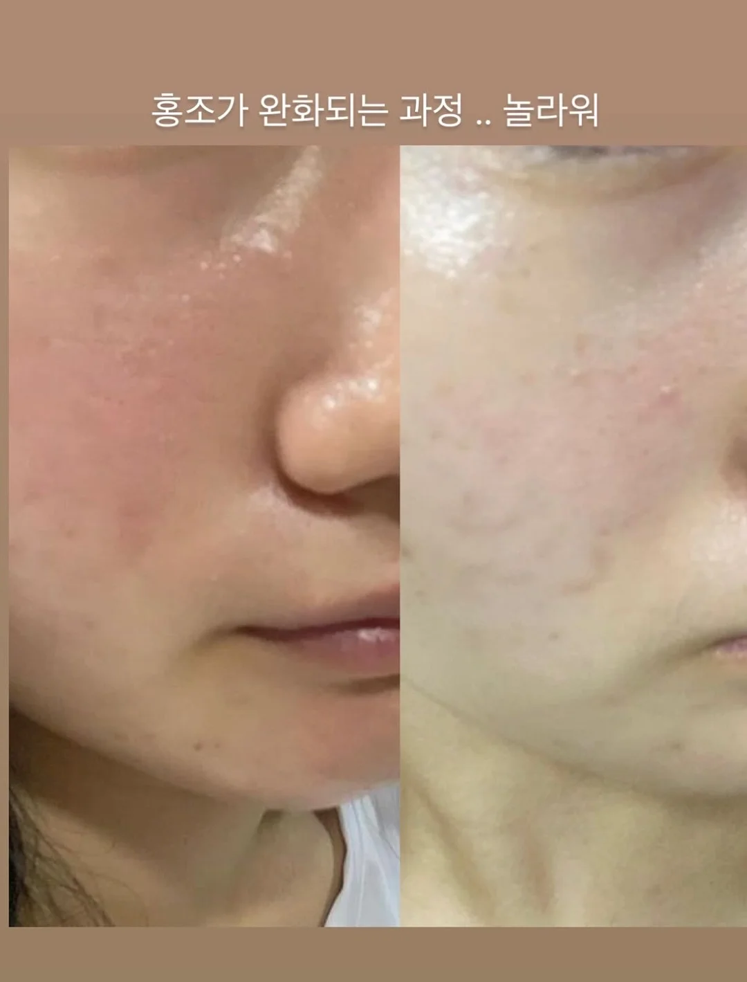 계란 우유 레시피 7