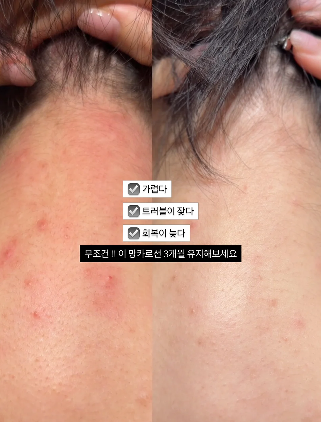 계란 우유 레시피 9
