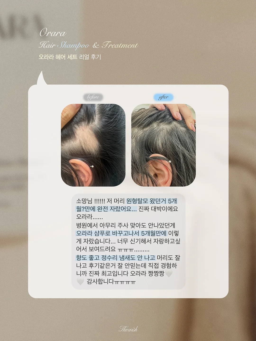 포레아 그란데 1DAY 15
