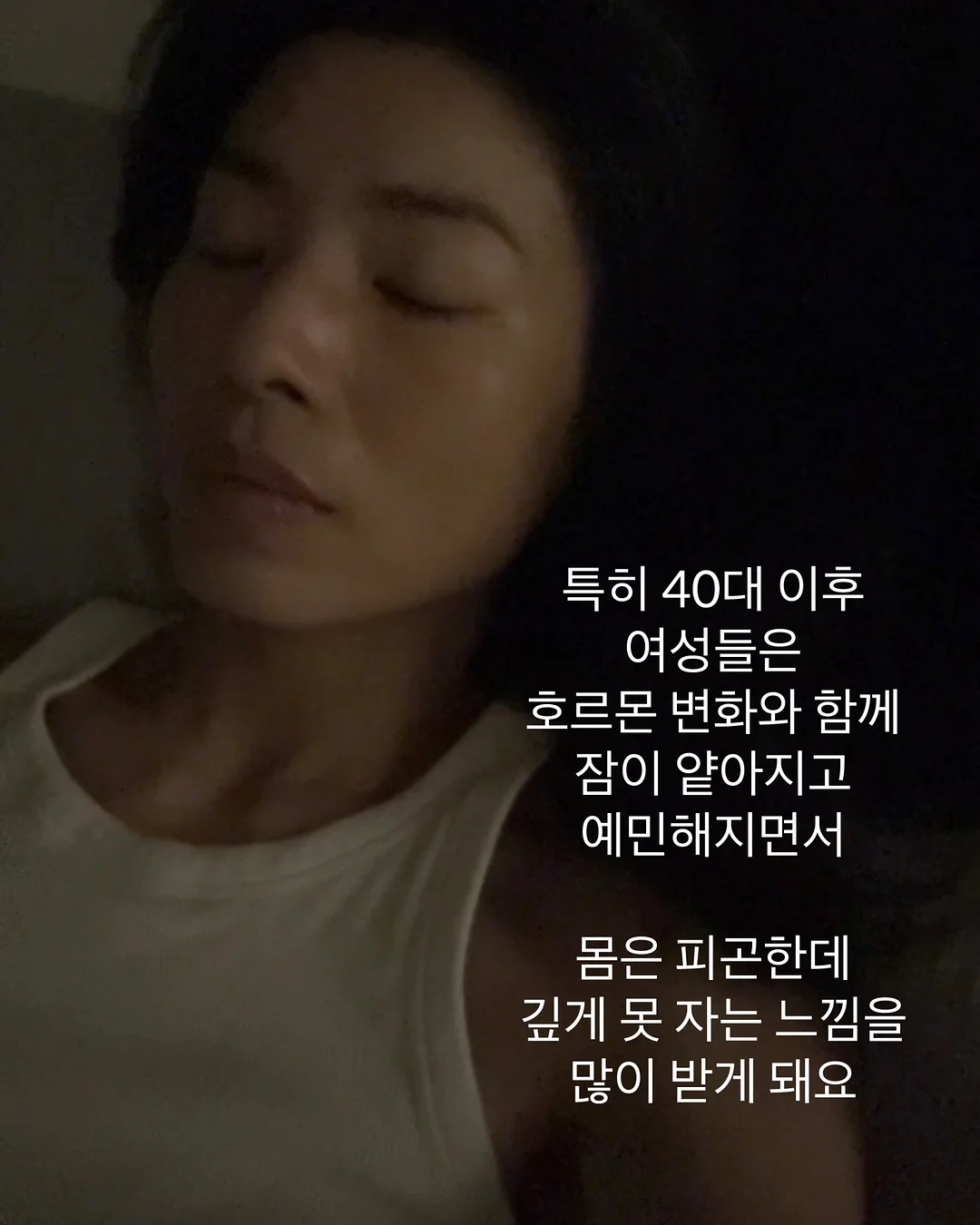 포레스트 원피스 5
