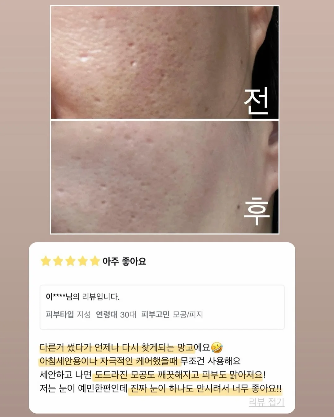 알비비 재생 비비 11