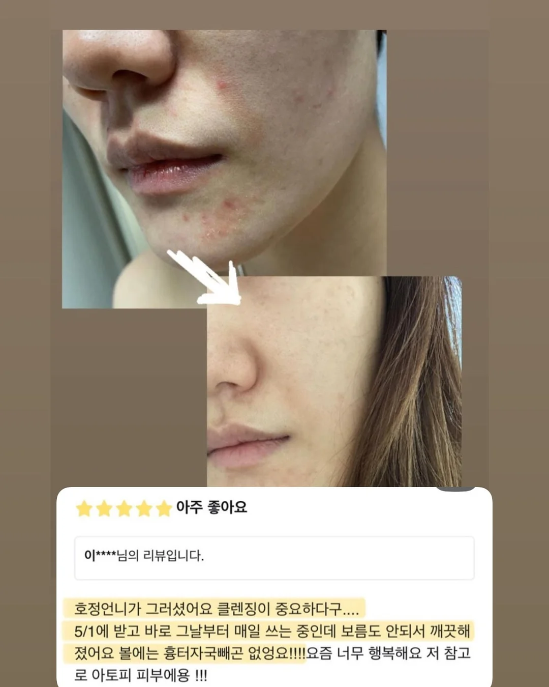 알비비 재생 비비 7