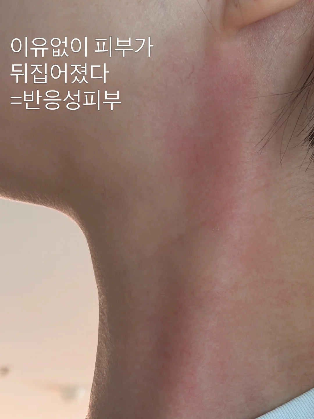 말랑이 1