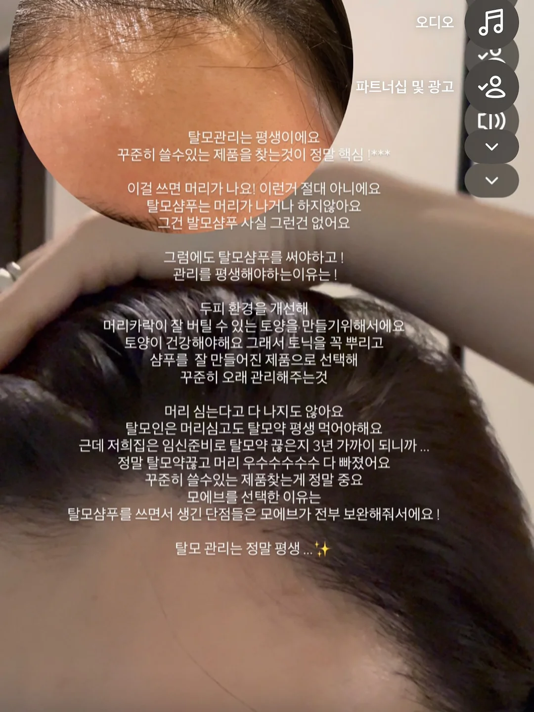 양우산 13