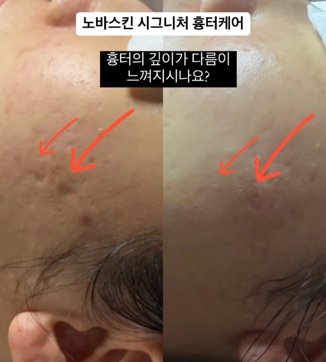 뉴이 썸머 올데이 원피스 5