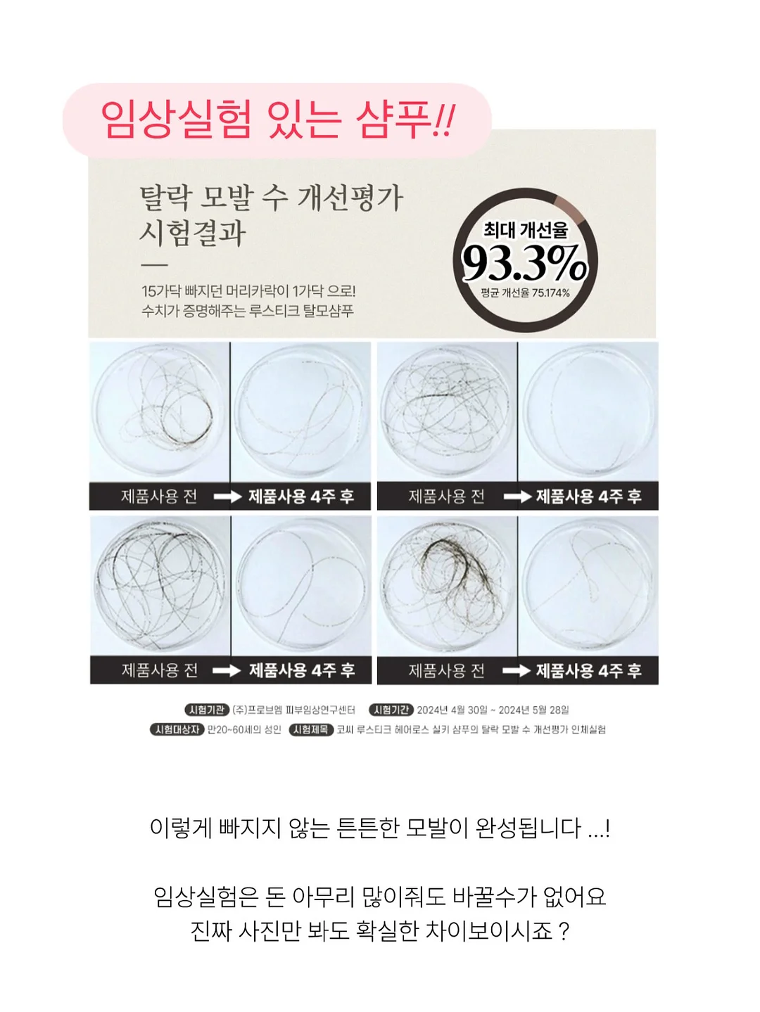바첸 접시팬 14