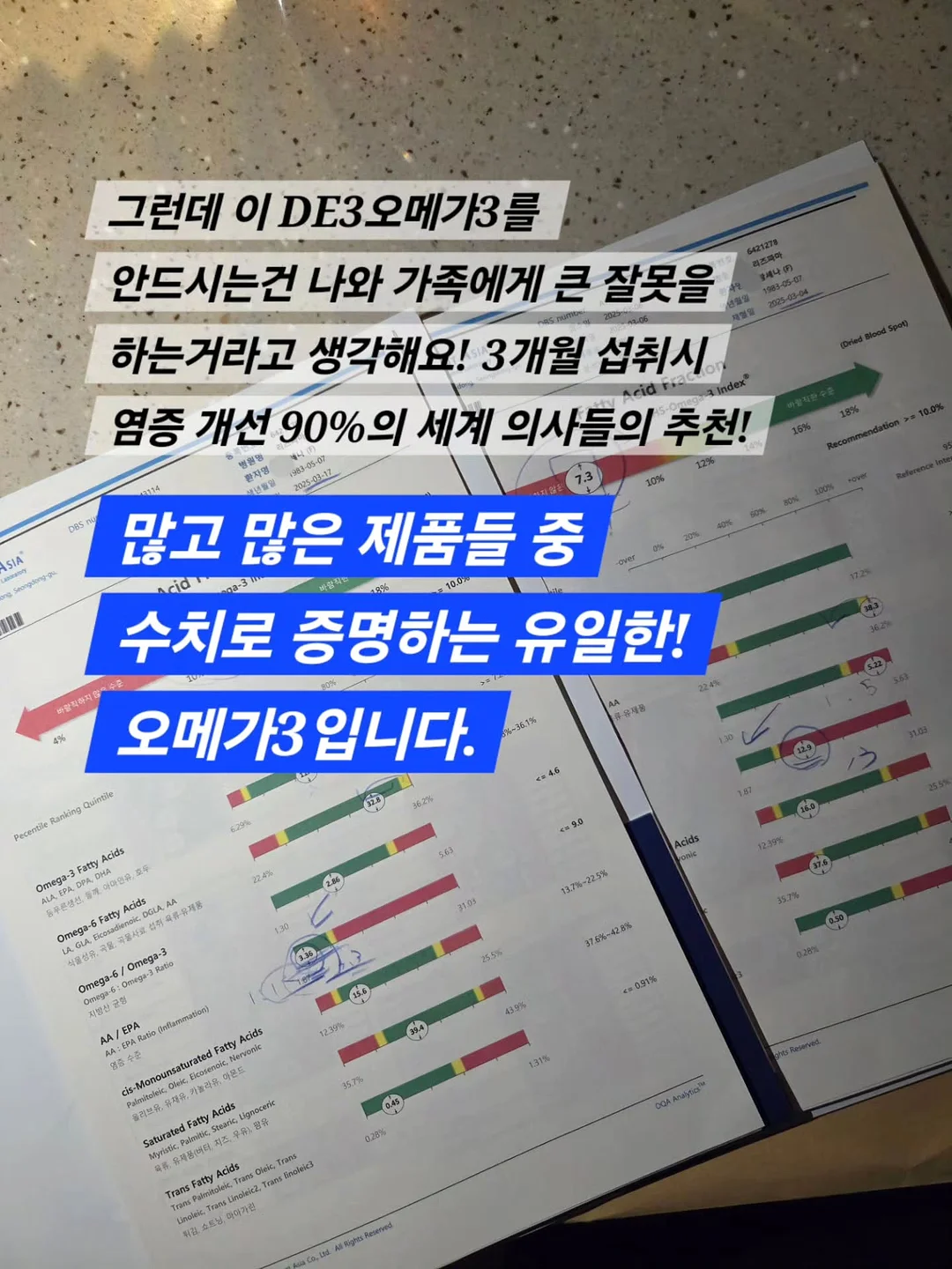 비밀요원 레너드 우리 고전 6