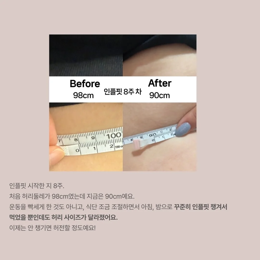 르메르원피스 18