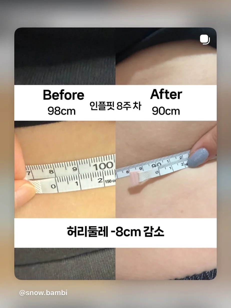 르메르원피스 9