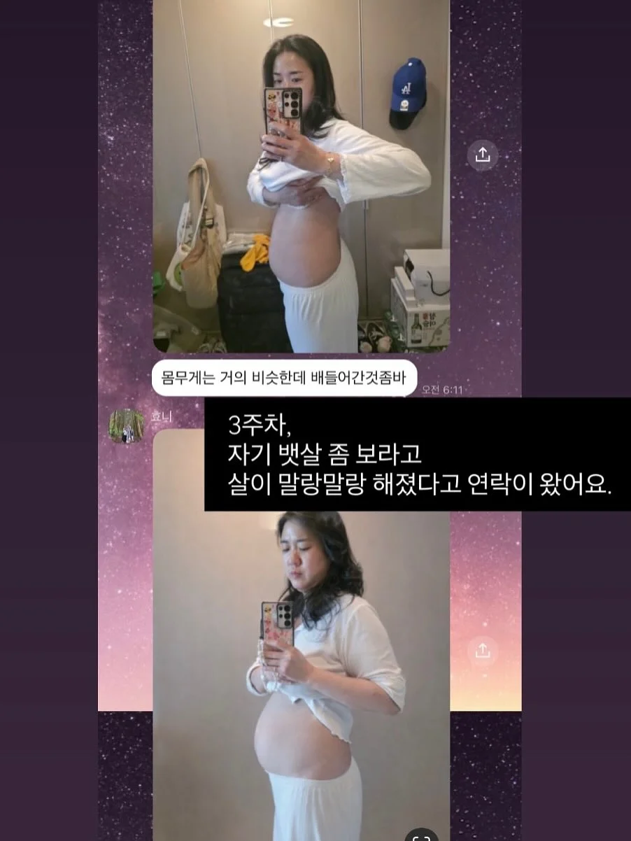 르메르원피스 10