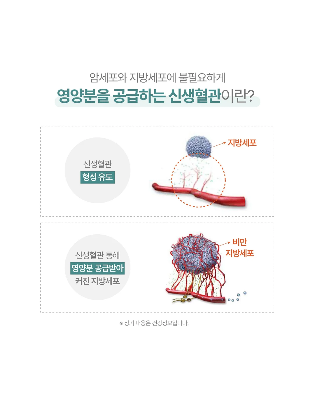헤어메스 2