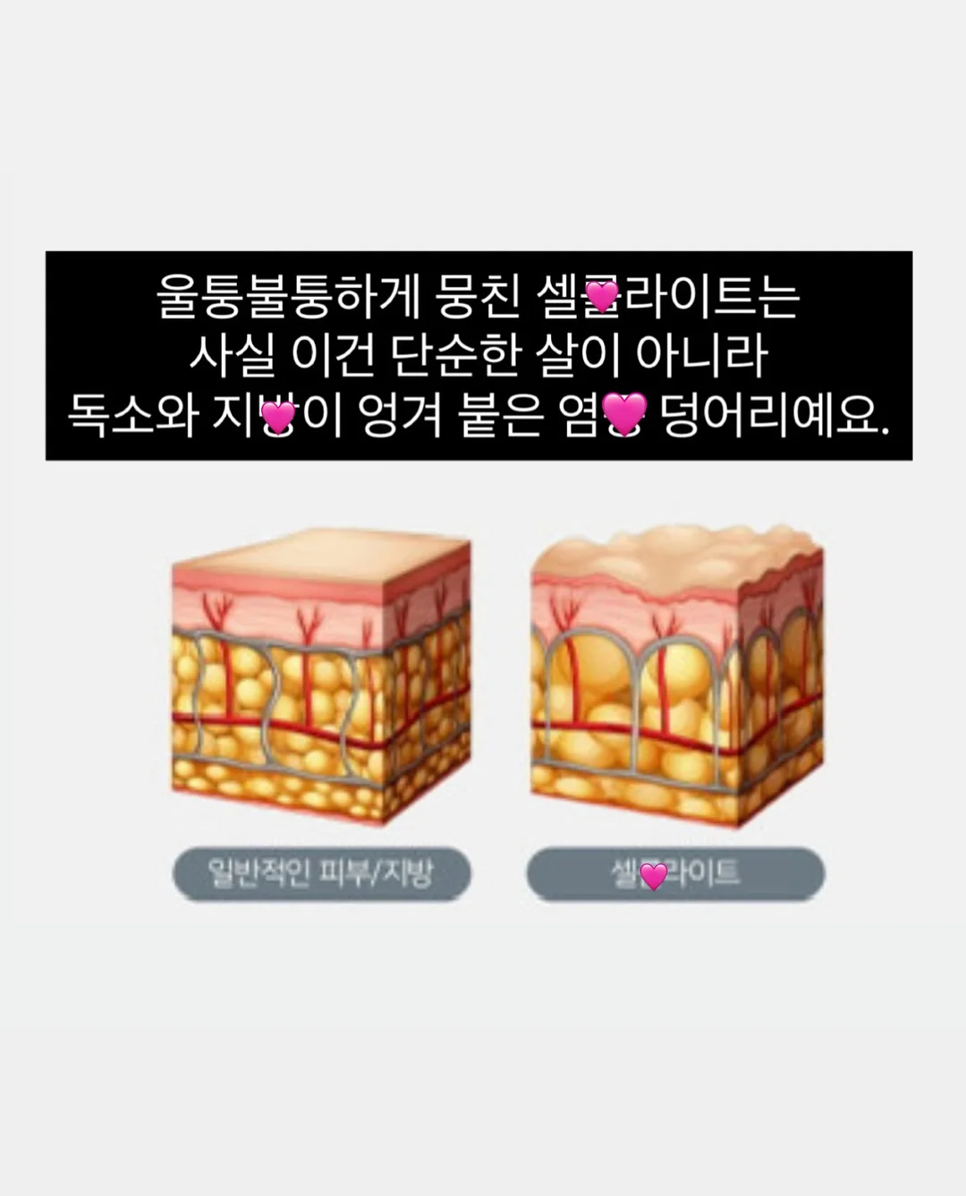 오이코스 마시멜로우 베개커버 2
