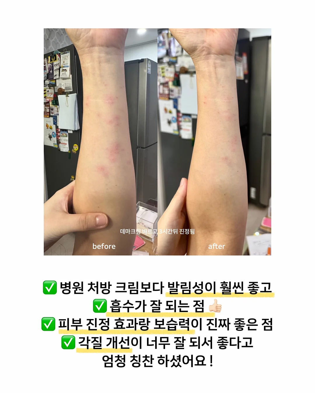 생새우 홈마카세 5