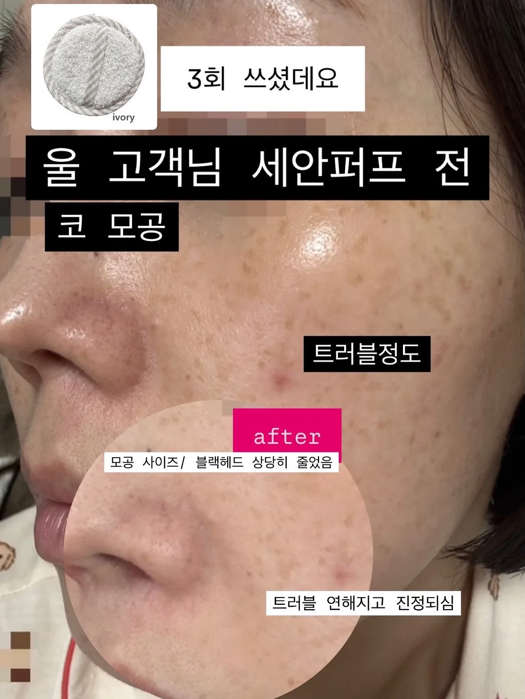 핀턱디테일셔츠자켓 7