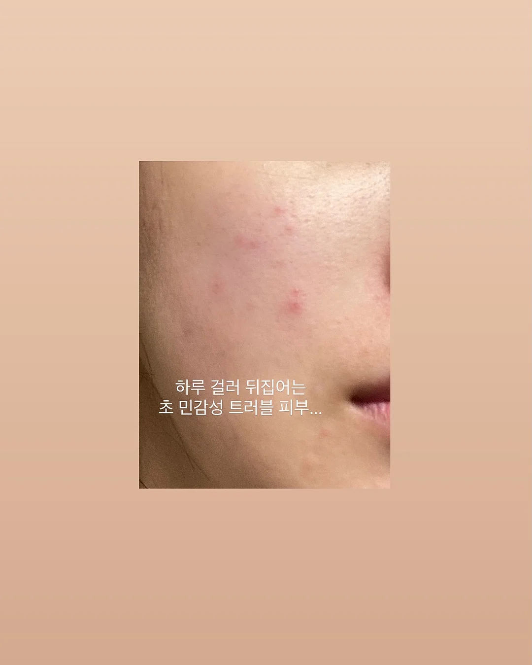 뉴트리코어 멜라바인 3