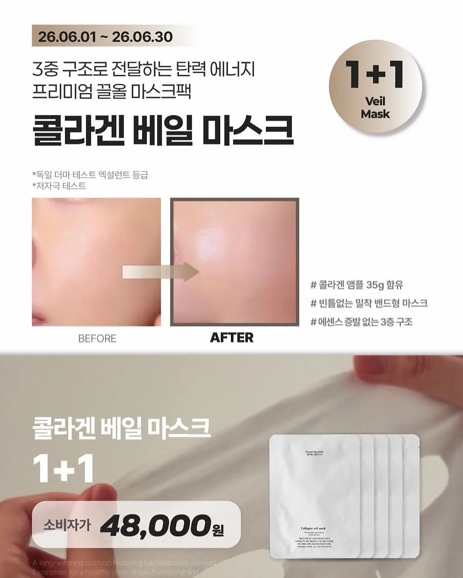 엘피다 여름 신발 3