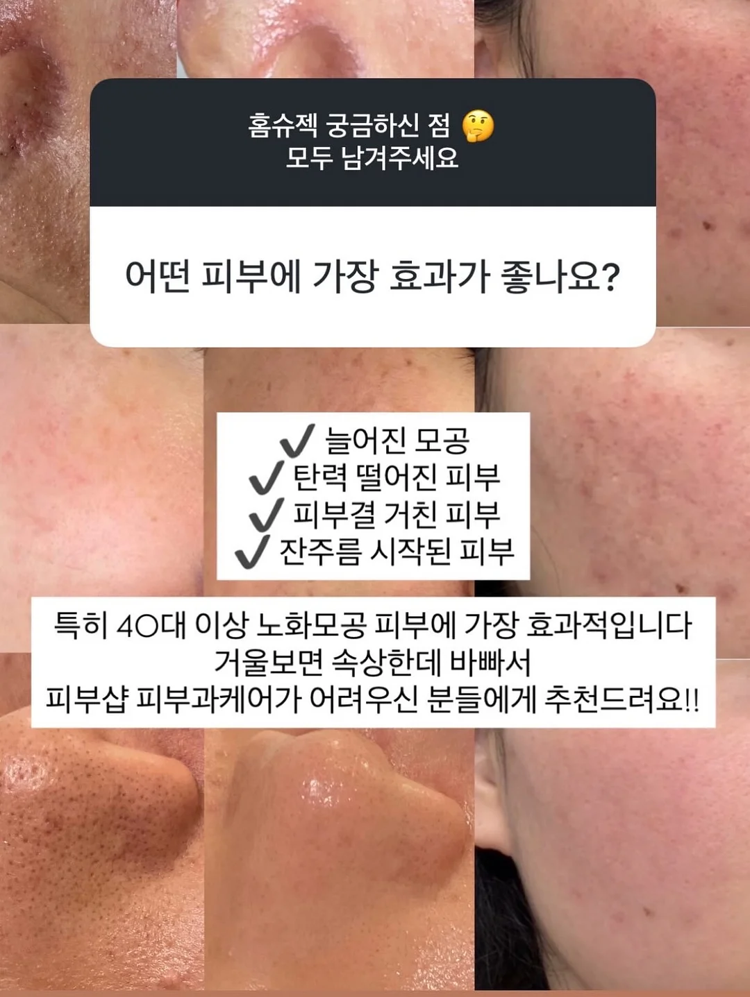 재생 에센스 13