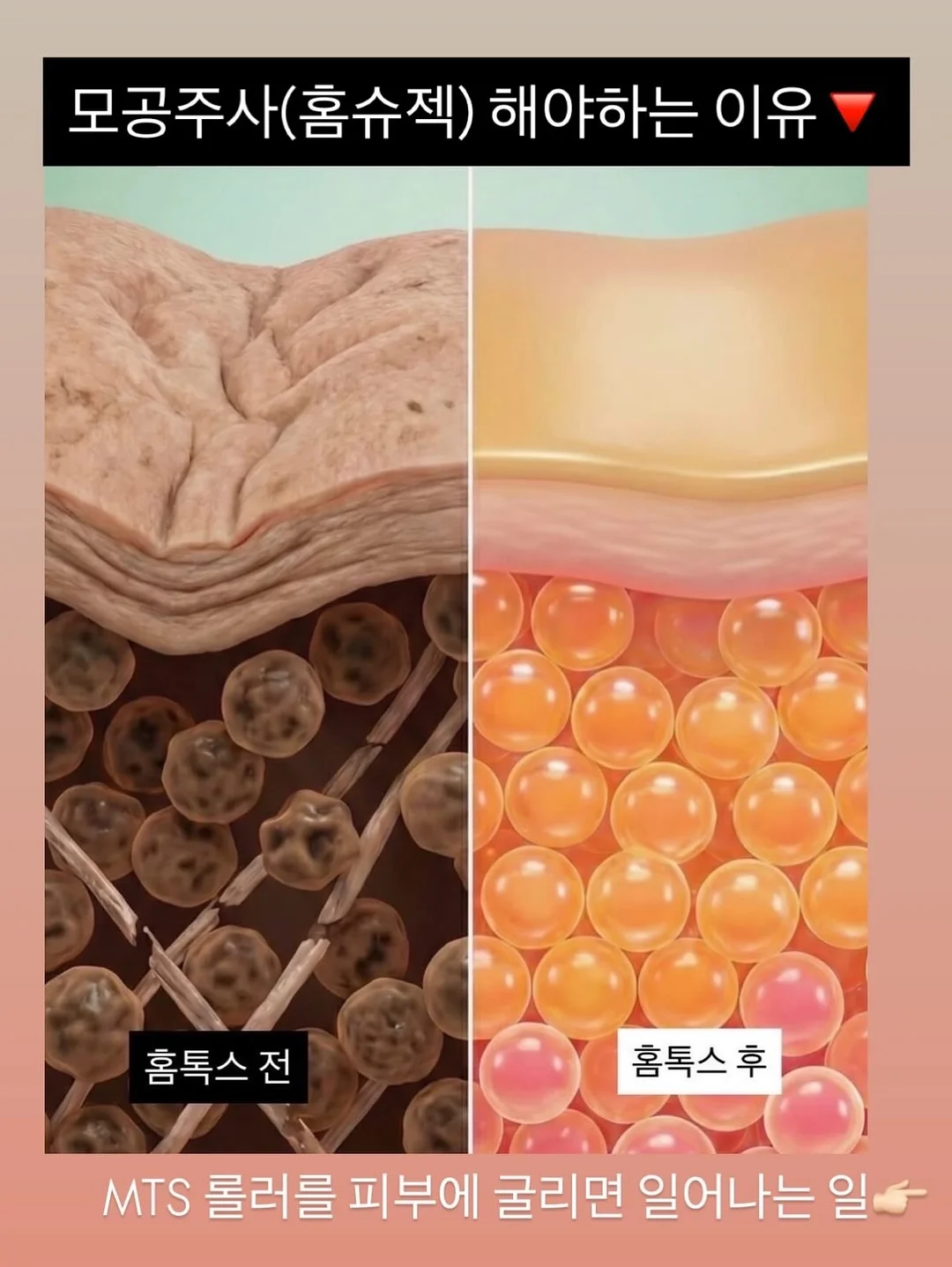 재생 에센스 3