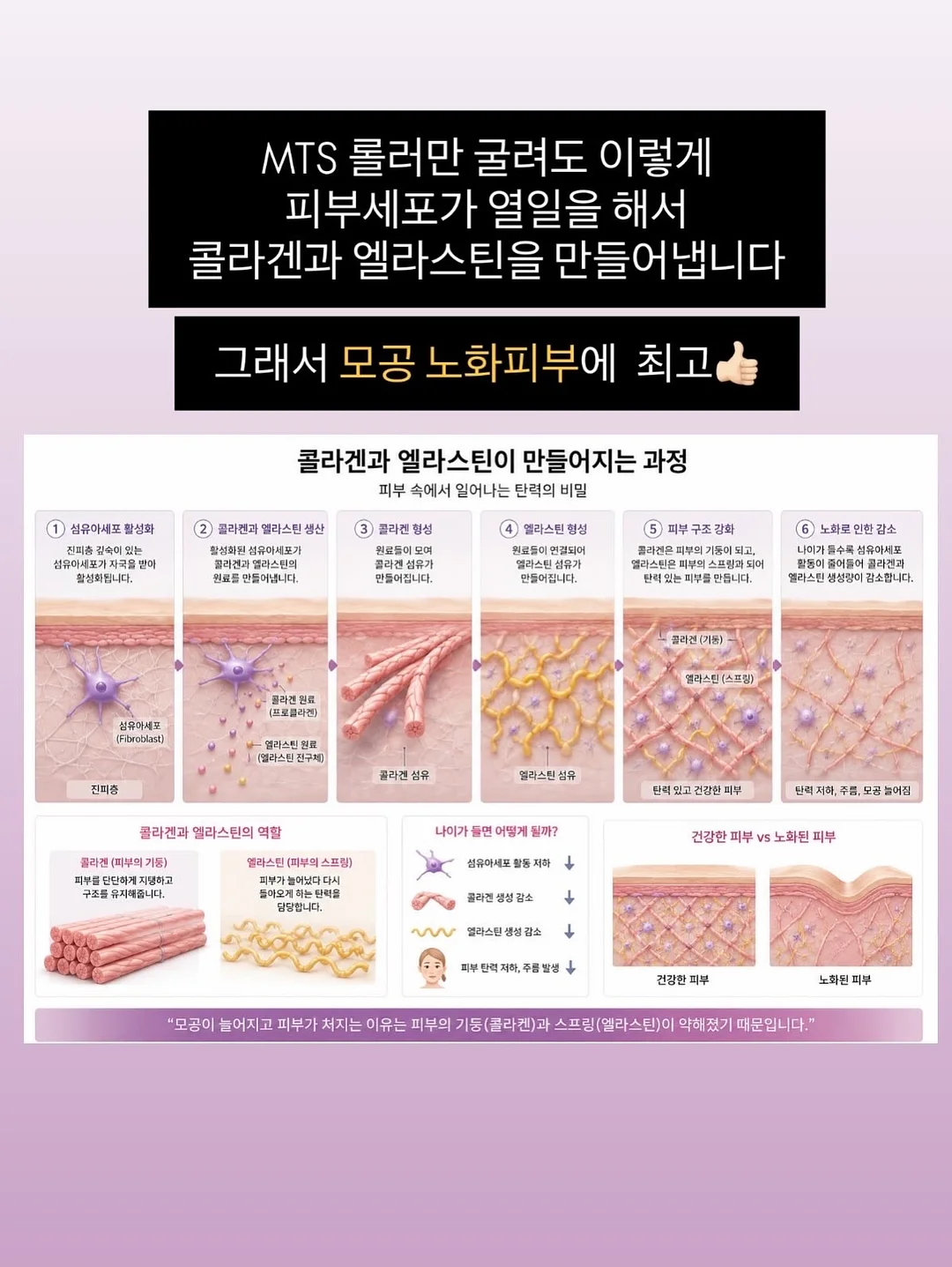 재생 에센스 4