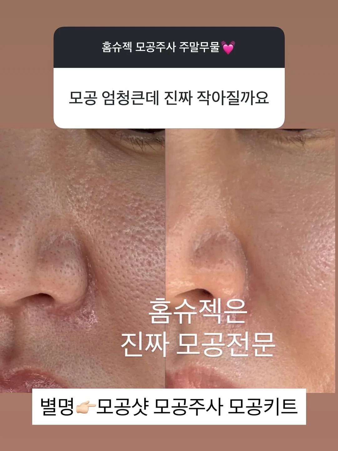 재생 에센스 6