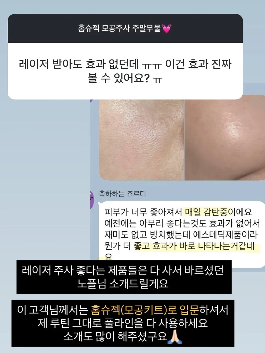 재생 에센스 8