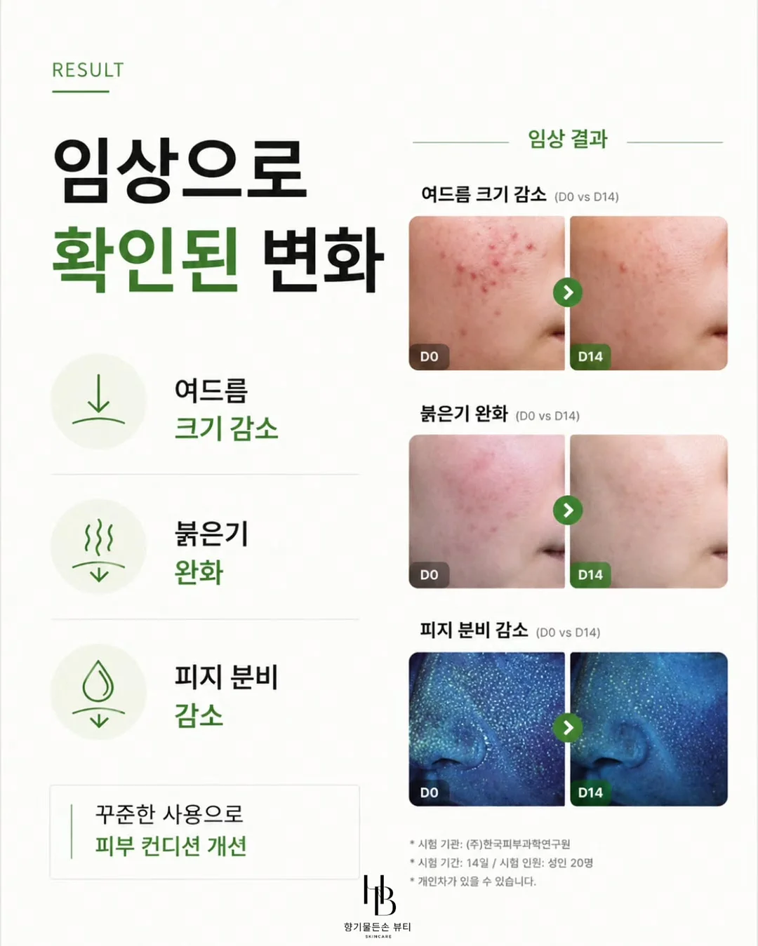 주방 아일랜드 4