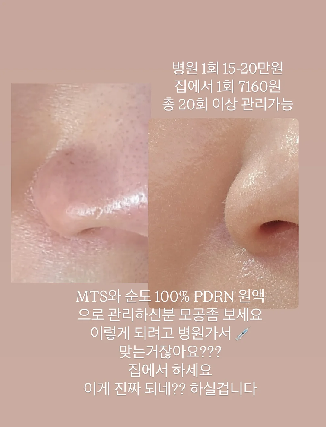 핑크시슬리 부츠컷 팬츠 5