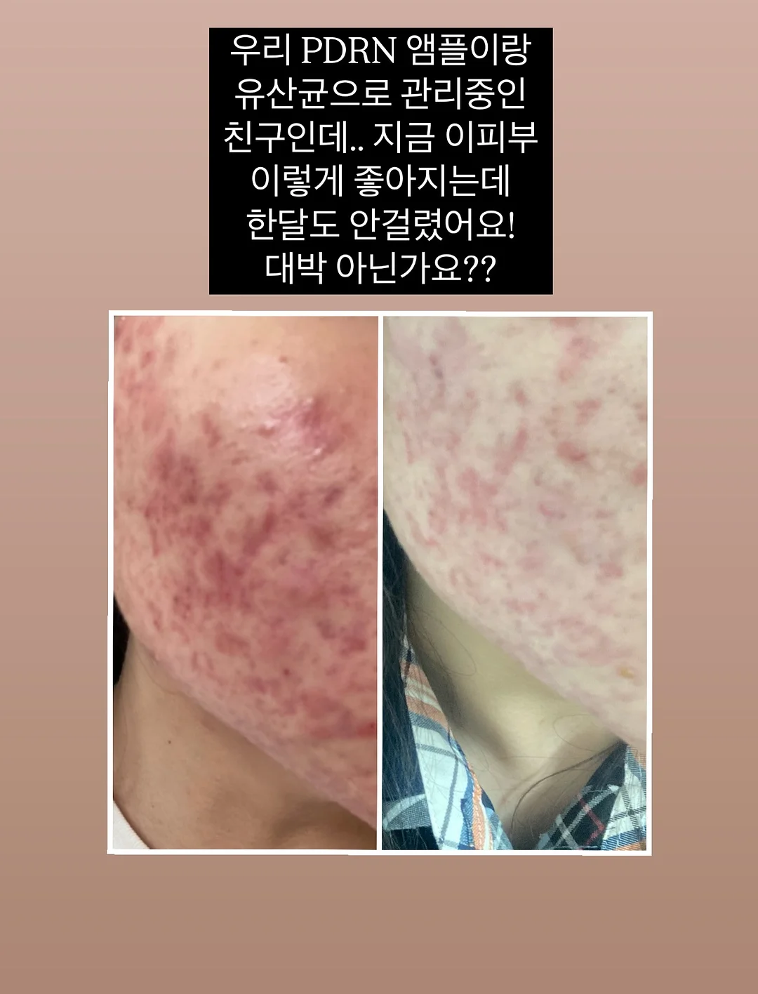핑크시슬리 부츠컷 팬츠 8