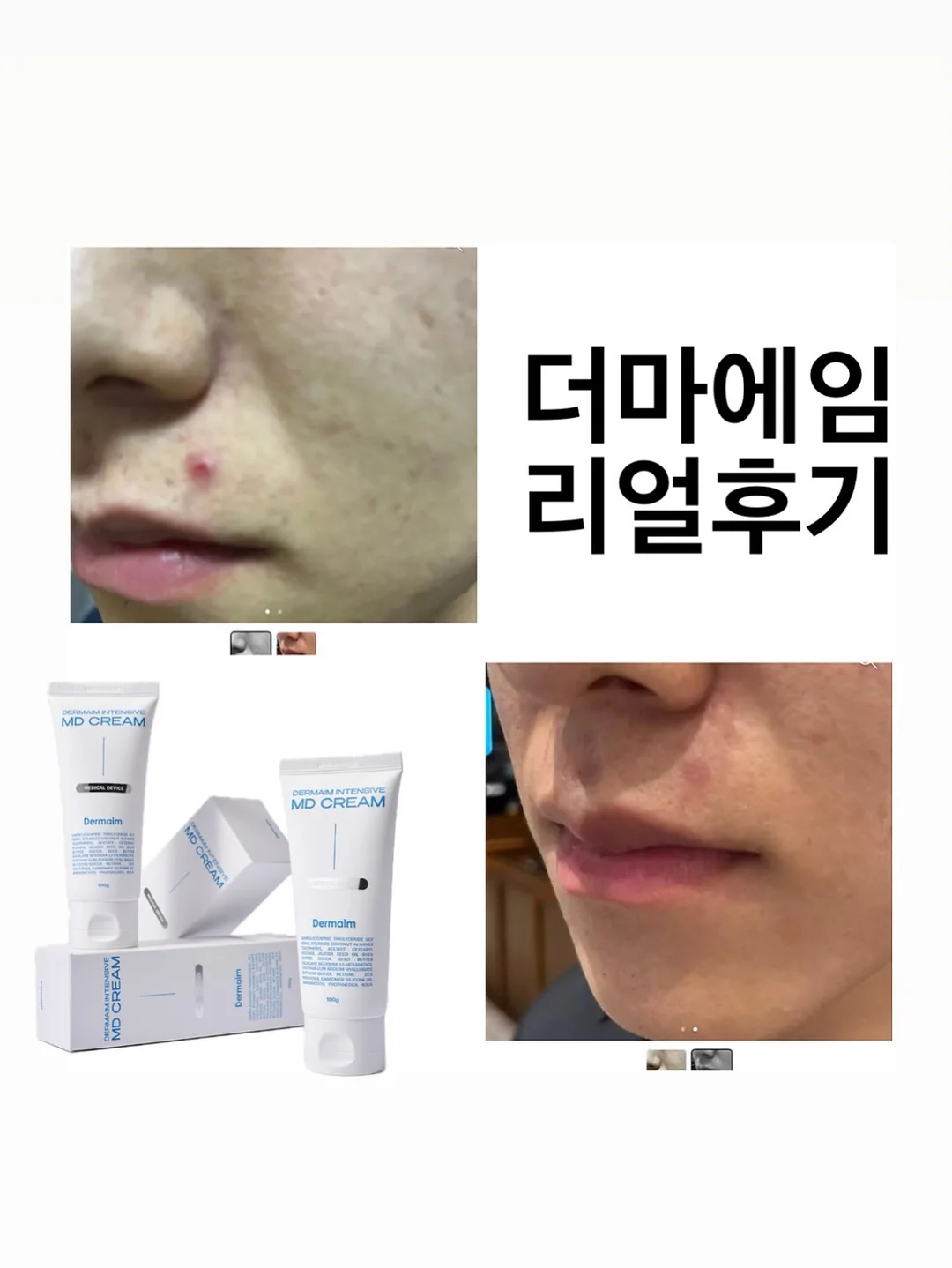 우산 커버 2