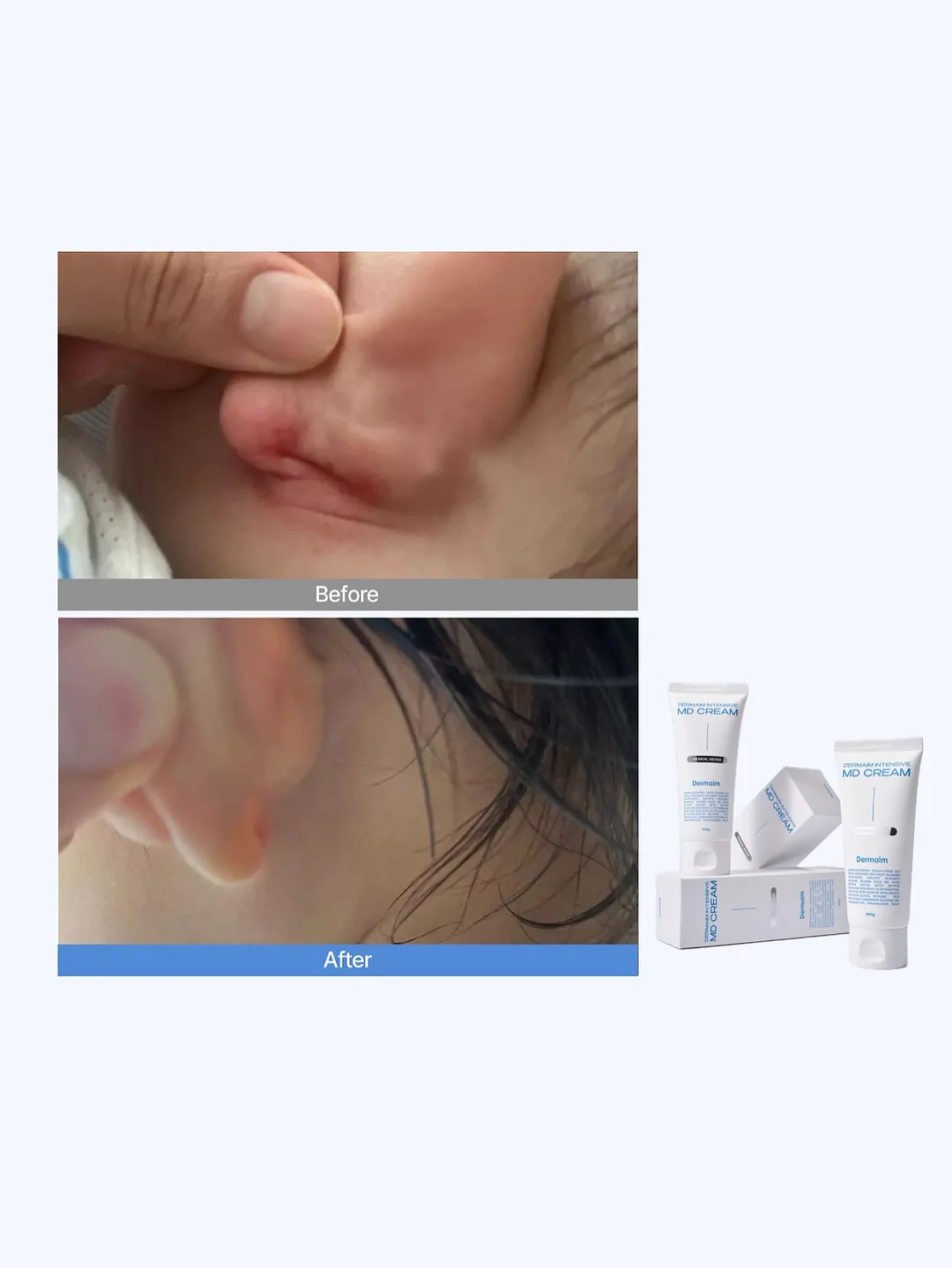 우산 커버 4