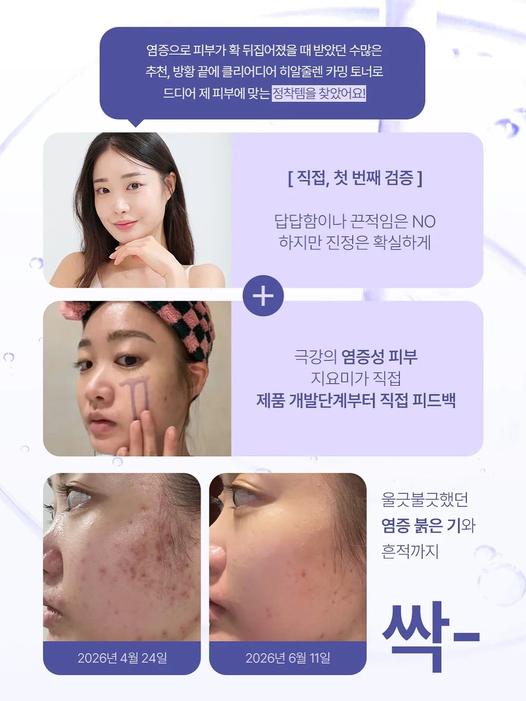 필 오프 립케어 4