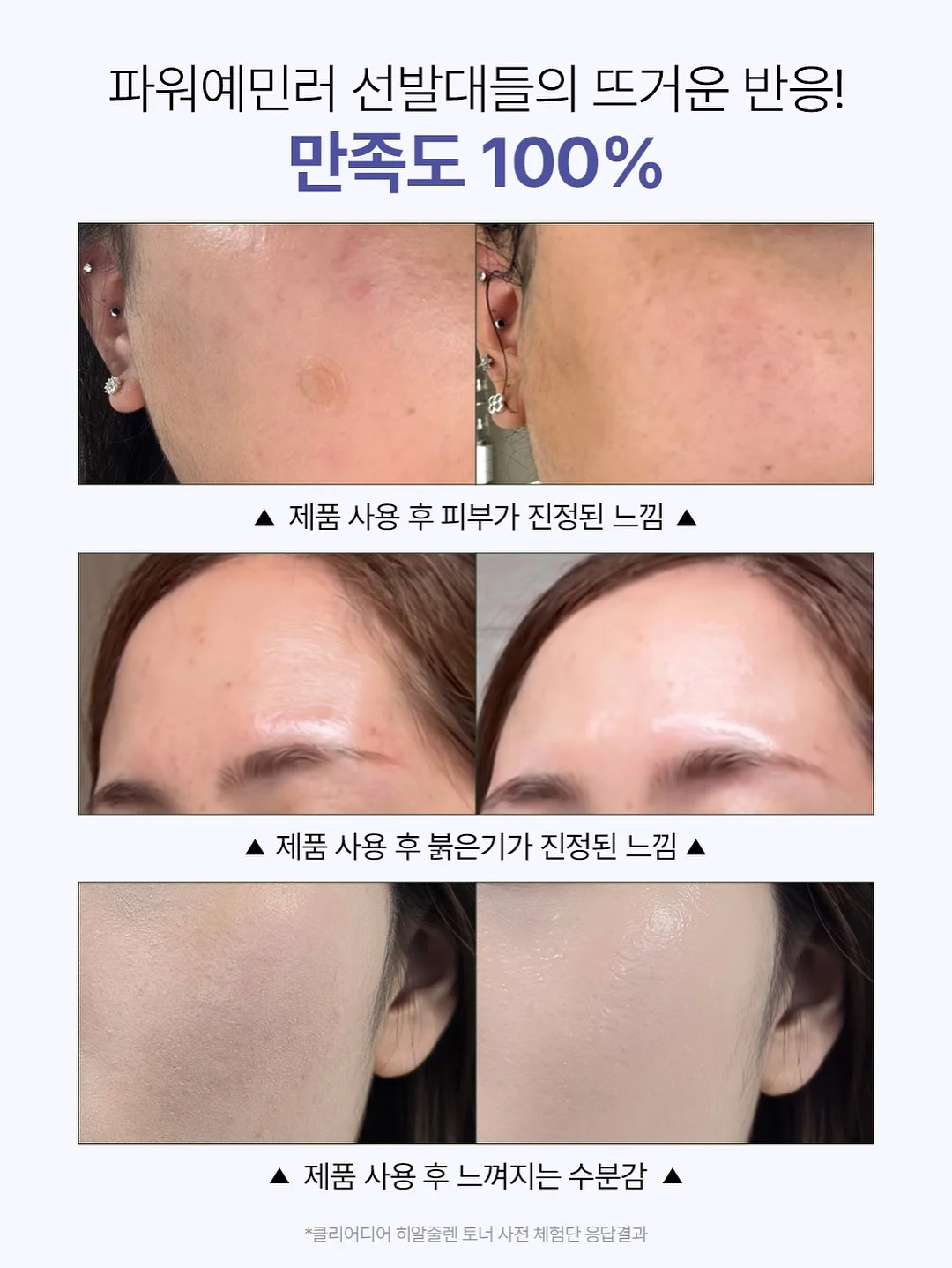 필 오프 립케어 5