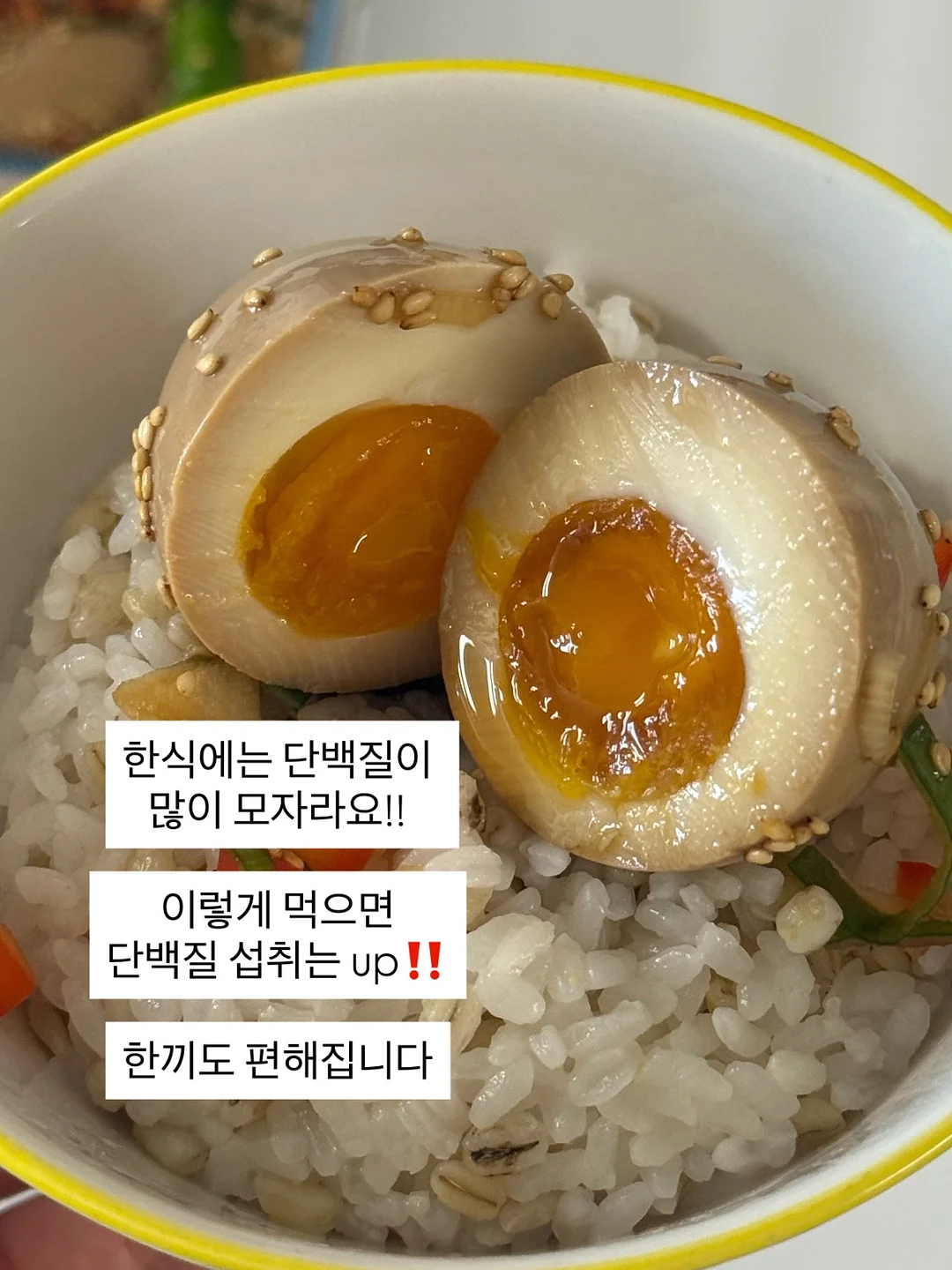케겔 운동 1