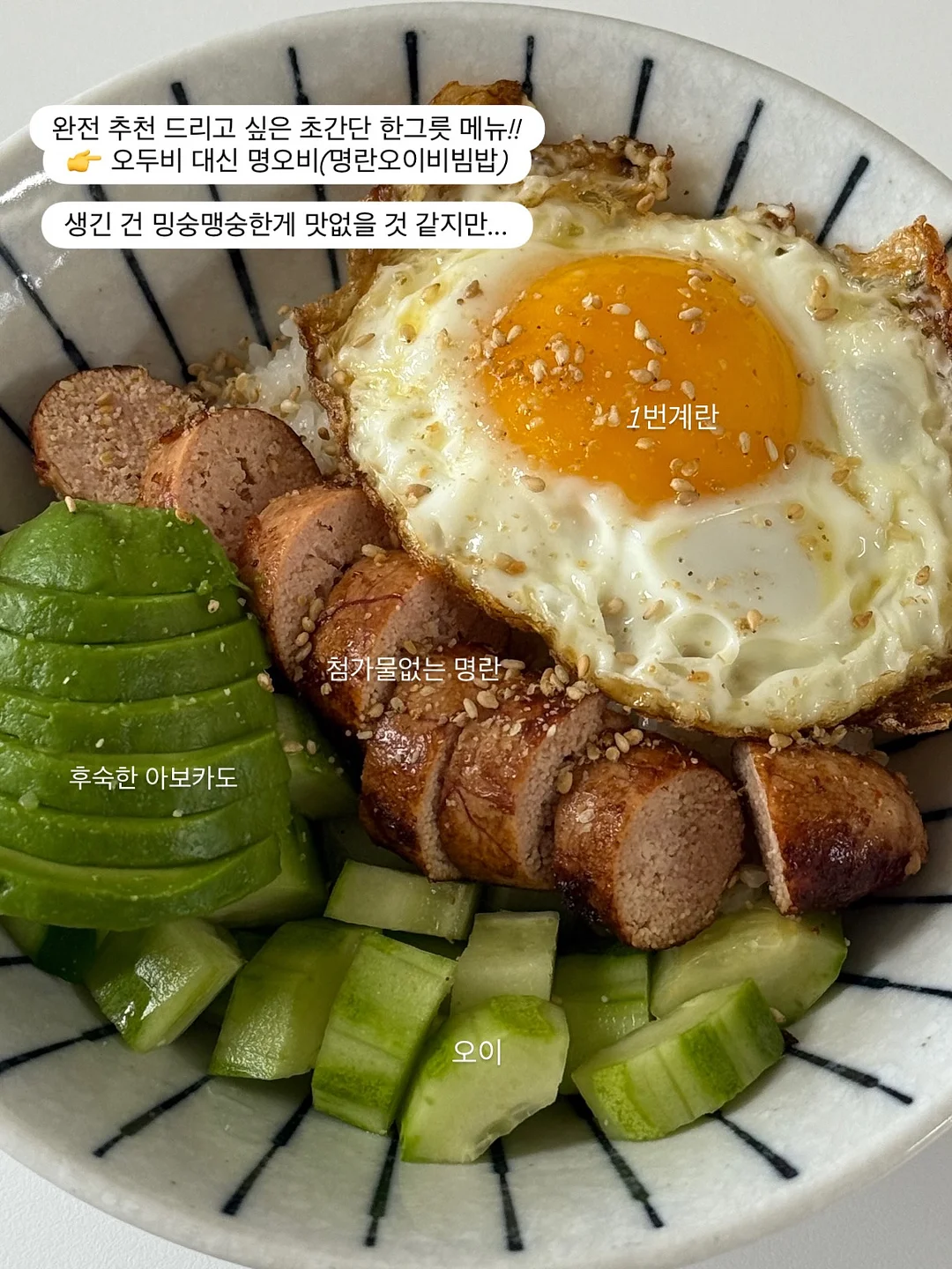 케겔 운동 7