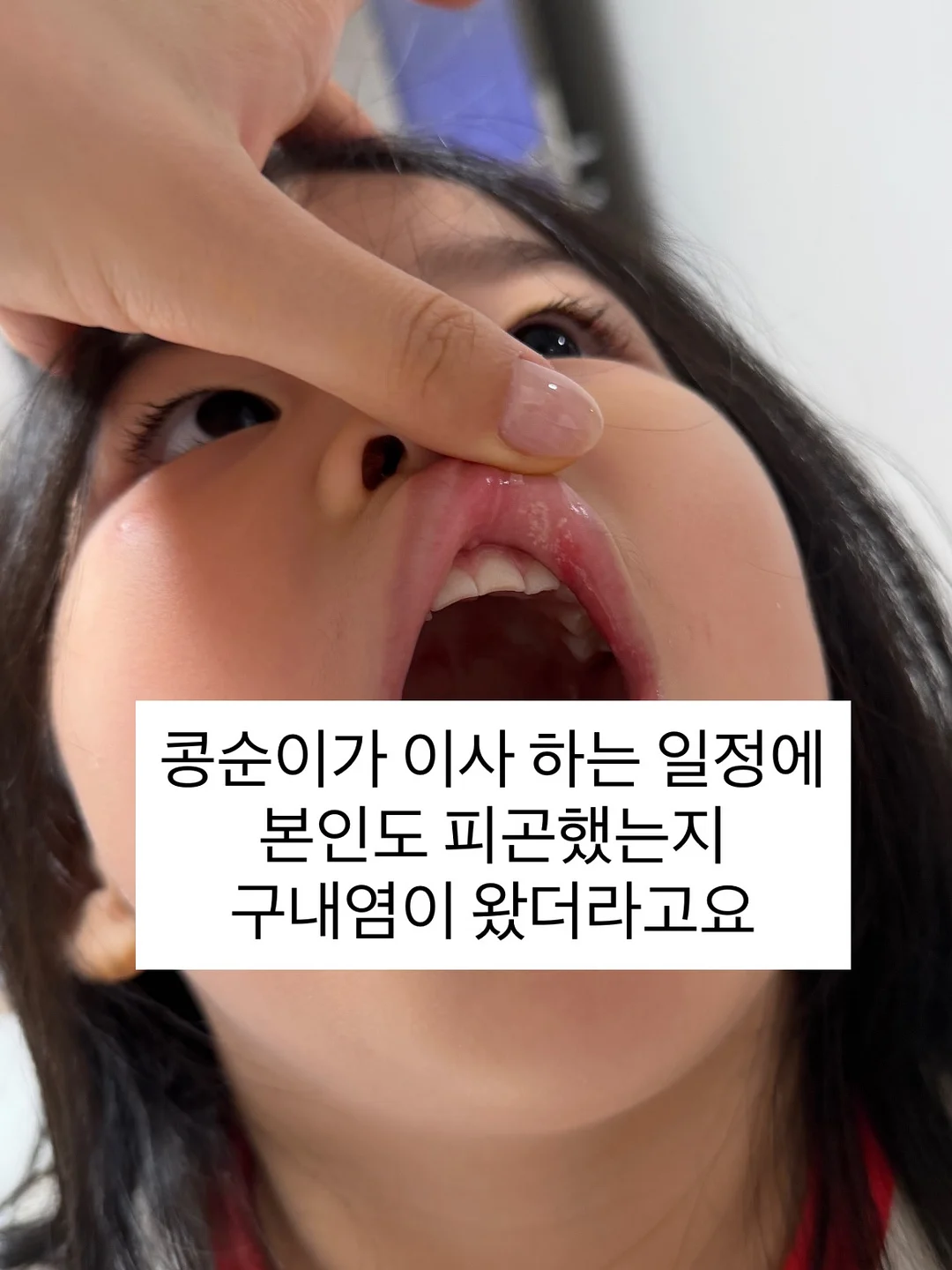 레이어드 브라탑 블랙 2
