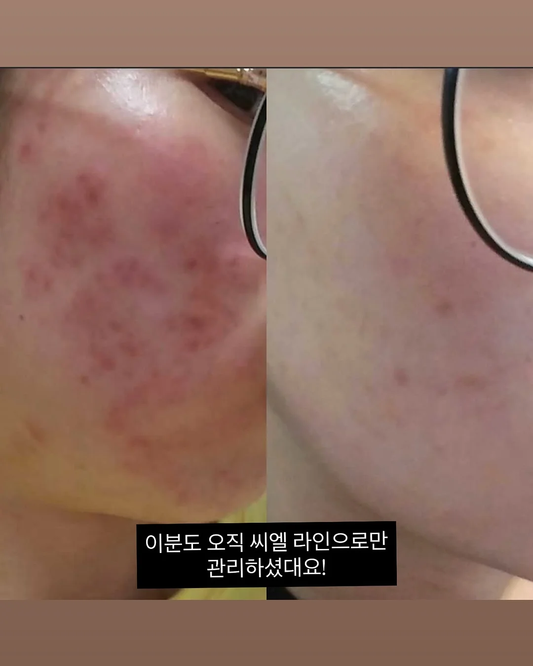 스위머 카와이 메이크업 파우치 아이보리 10