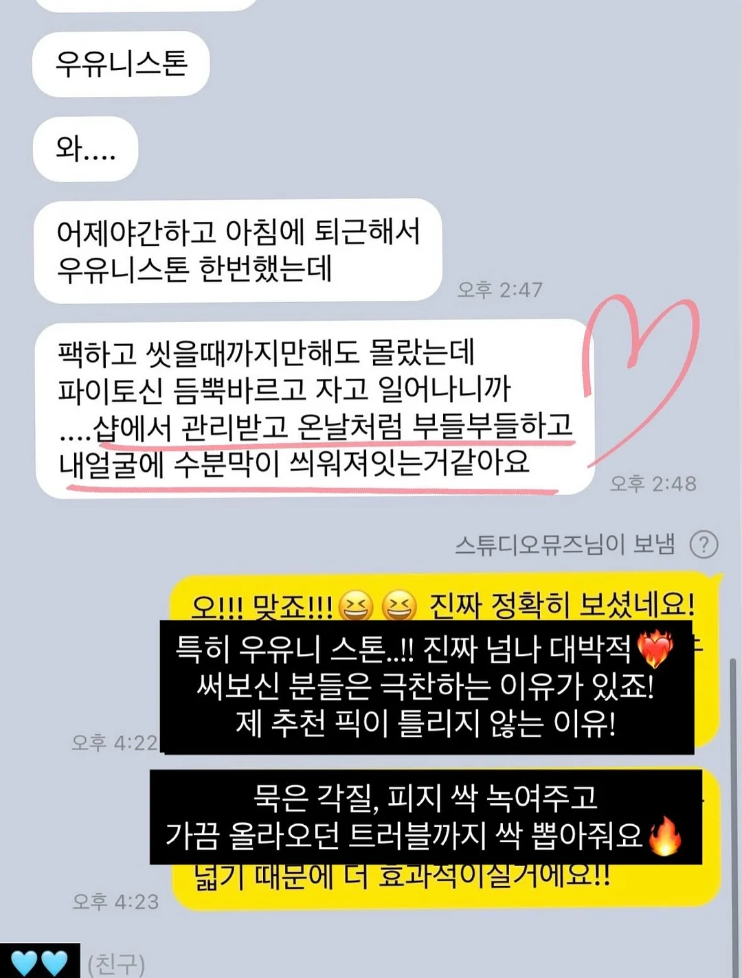 전동조이스틱튜브 11