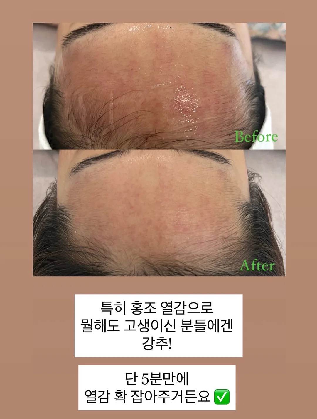 전동조이스틱튜브 5