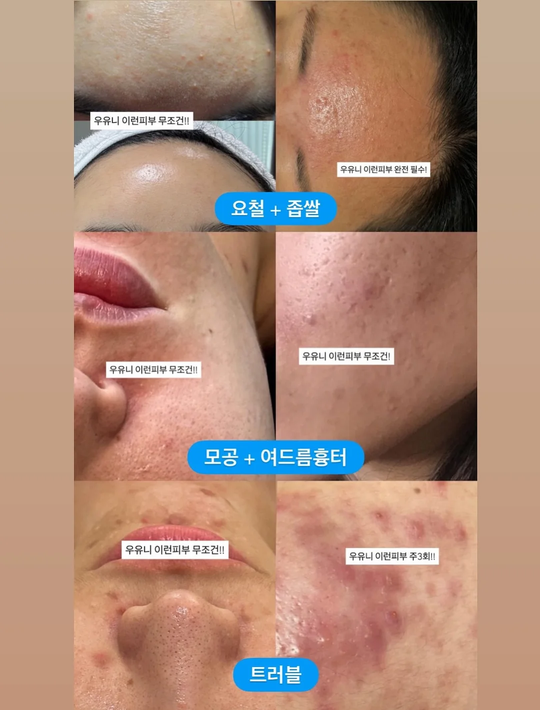 전동조이스틱튜브 9