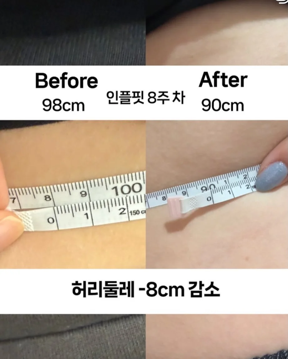 BELLZIP 뜨개 키트 15
