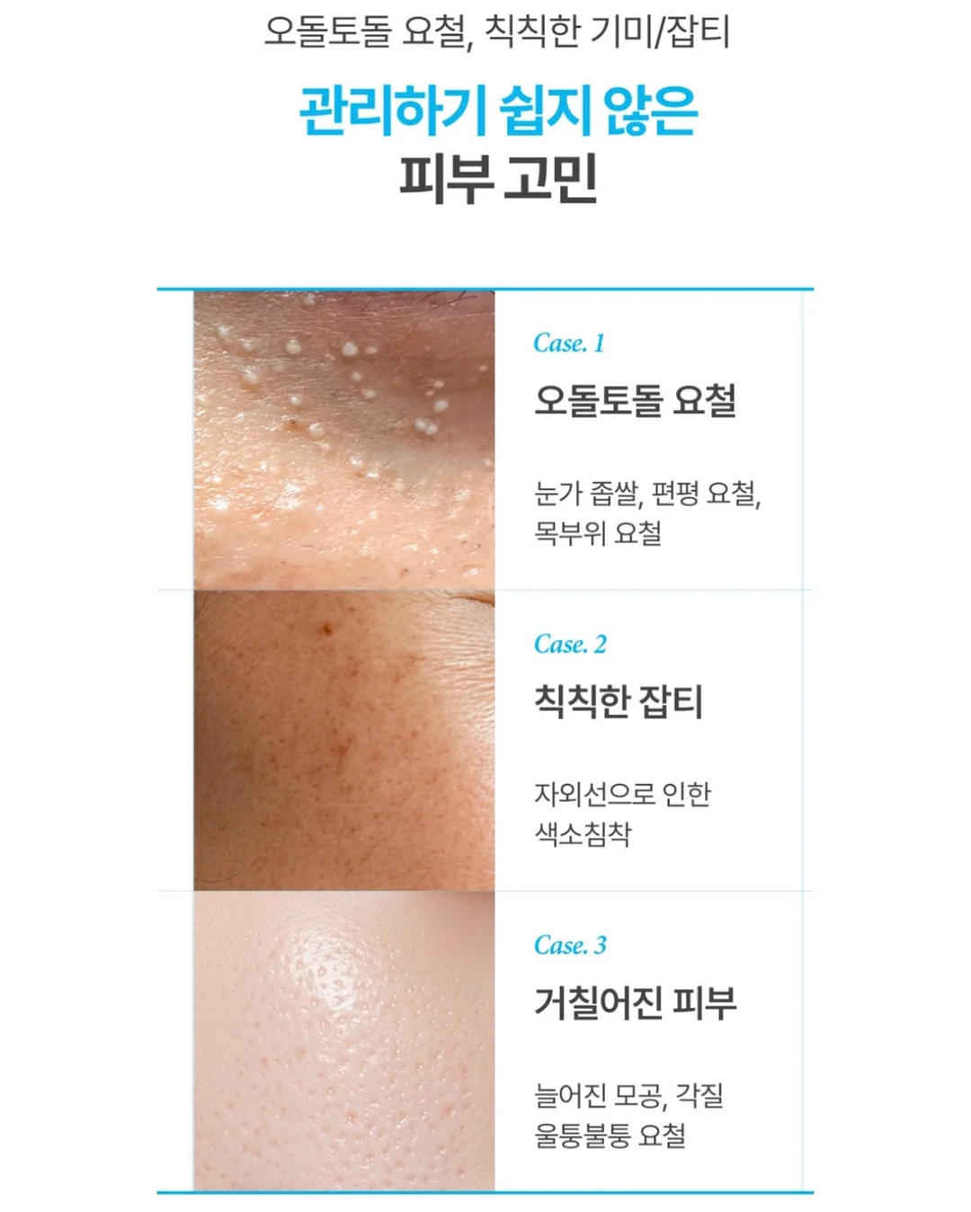 문가영 힐링템 허브 오일 12