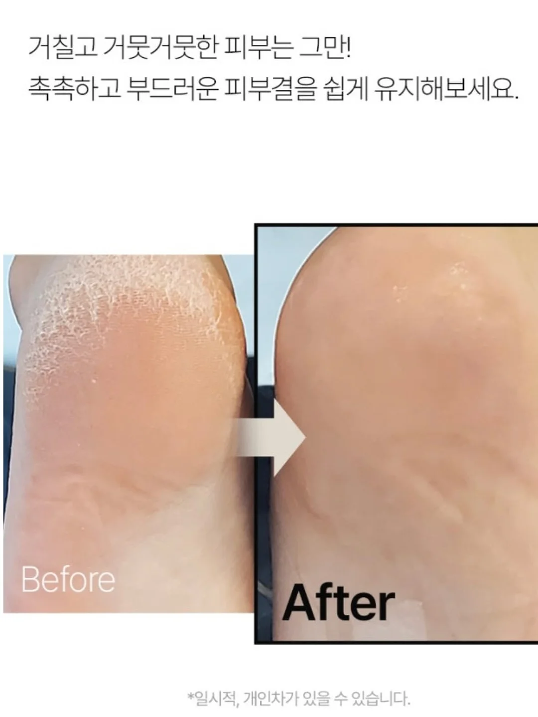 IMI 올스텐 냄비 프라이팬 웍팬 스테이크팬 8