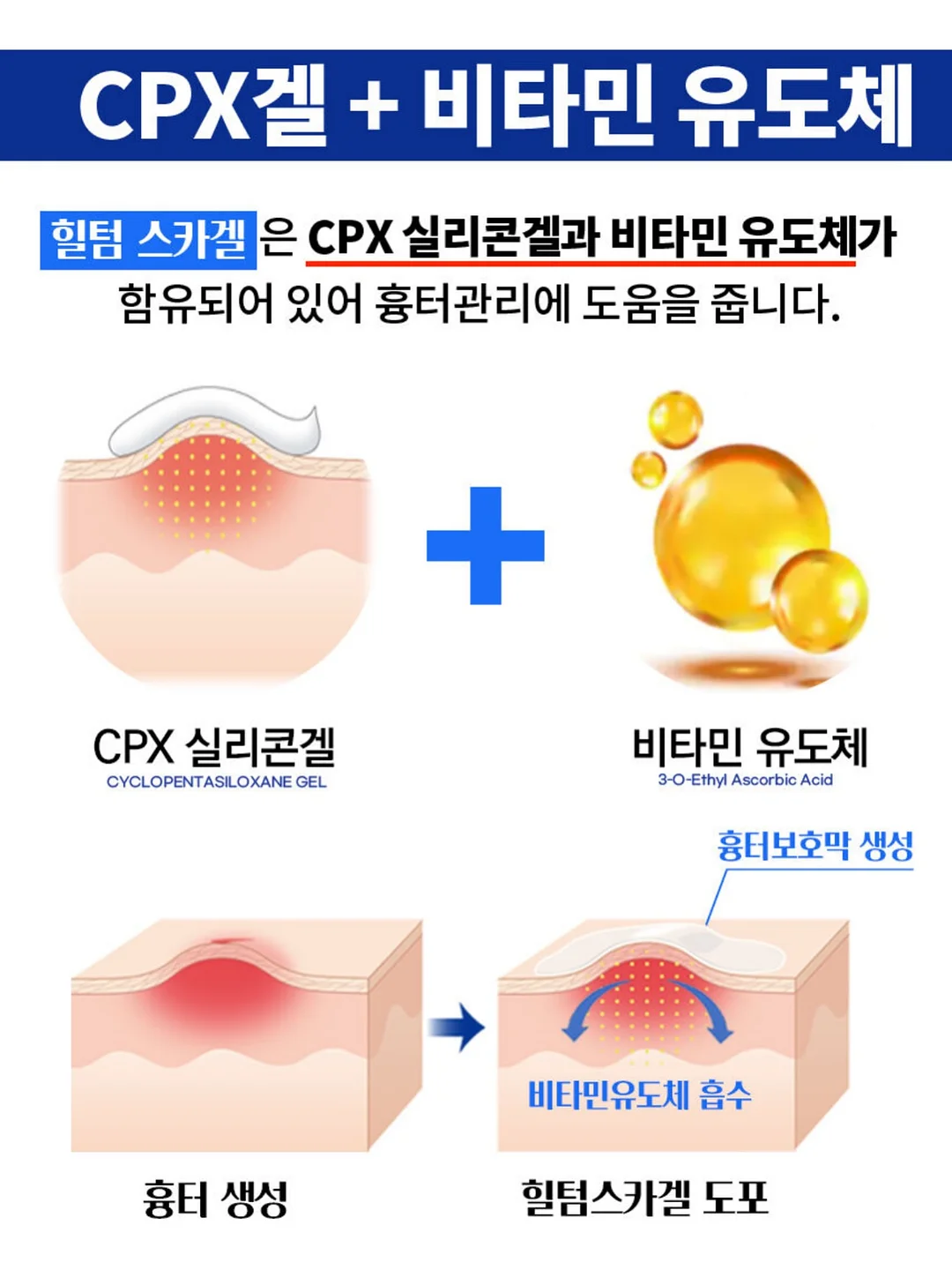 모자 세탁기 2