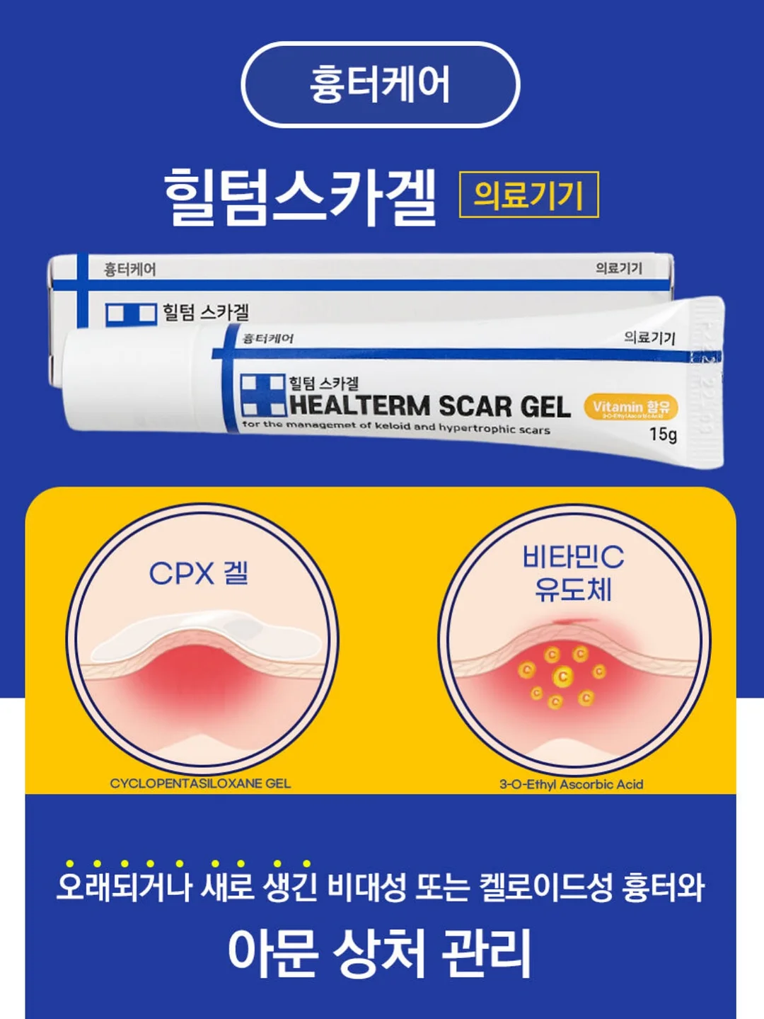모자 세탁기 3