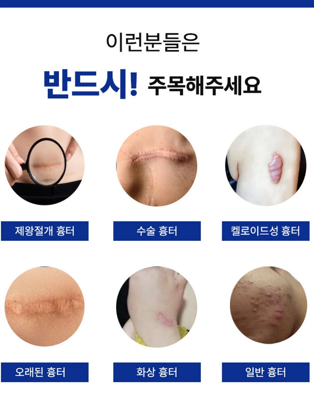 모자 세탁기 4