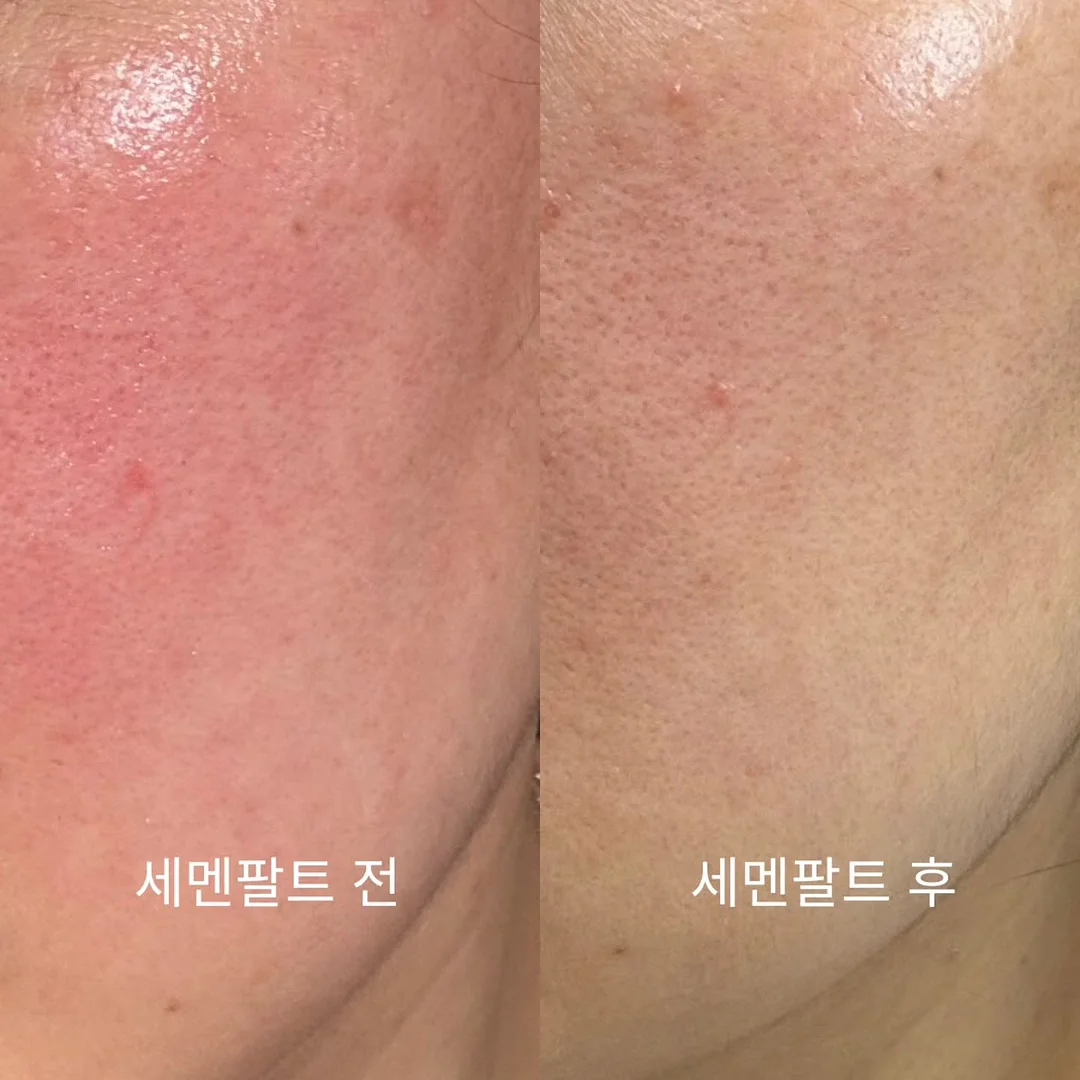 숲이 여름을 기억하게 된다면 4