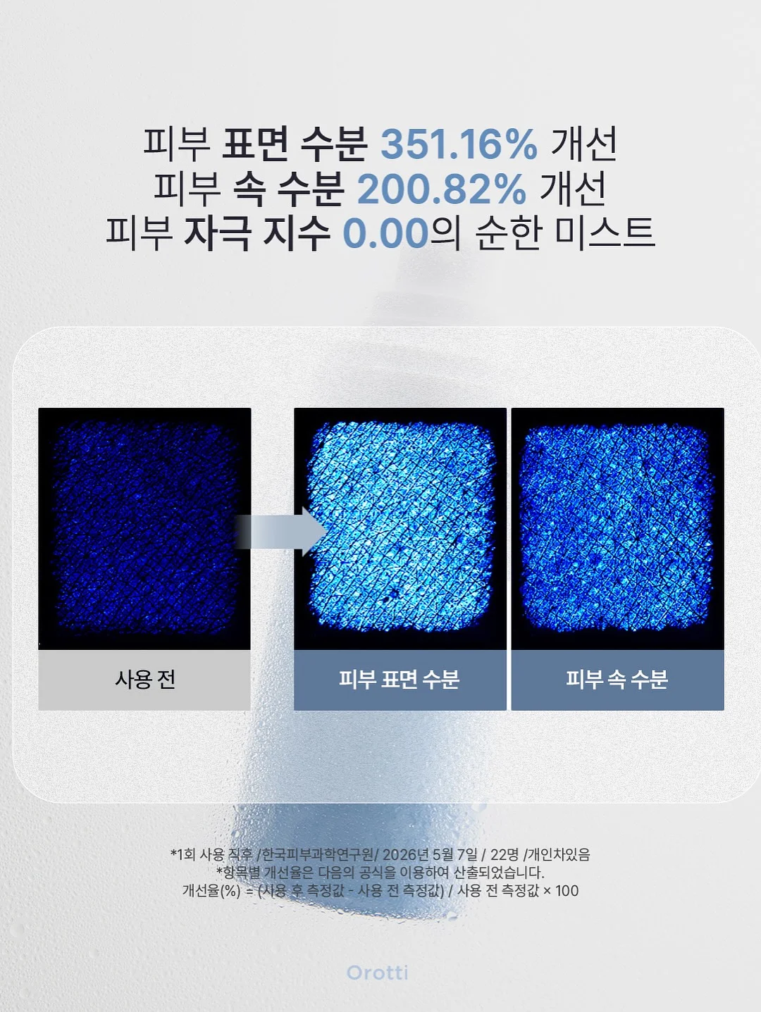 레이스 디테일 세트 3