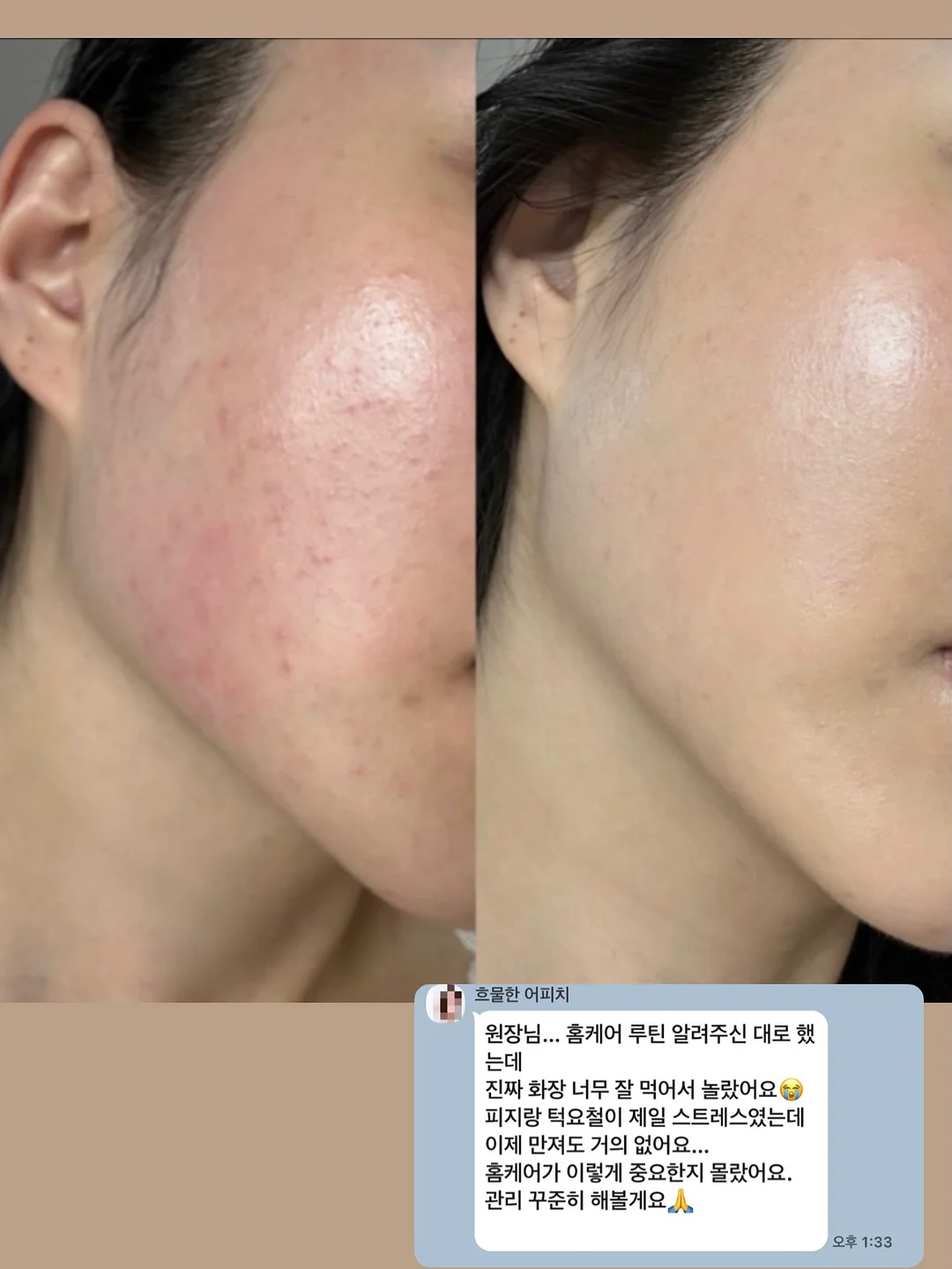 레스큐세럼 14
