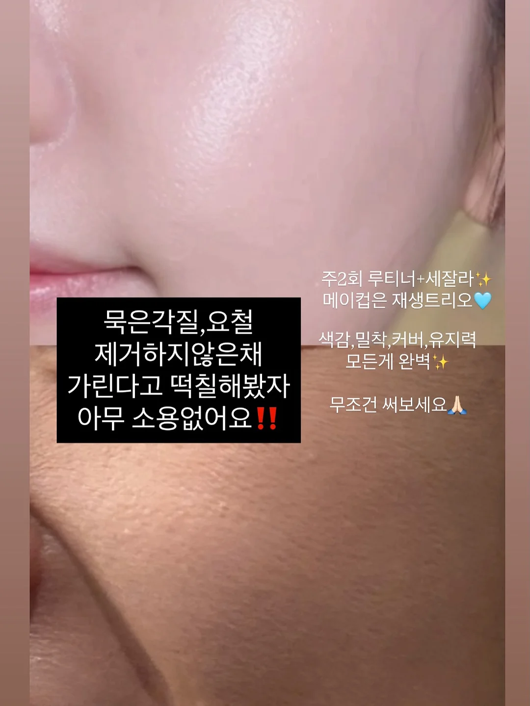 레스큐세럼 8